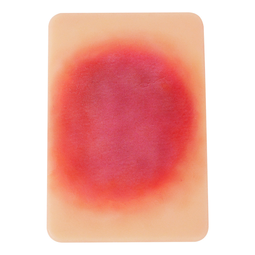Bacterial Infection Display Cards(4 Types)