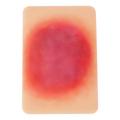 Bacterial Infection Display Cards(4 Types)