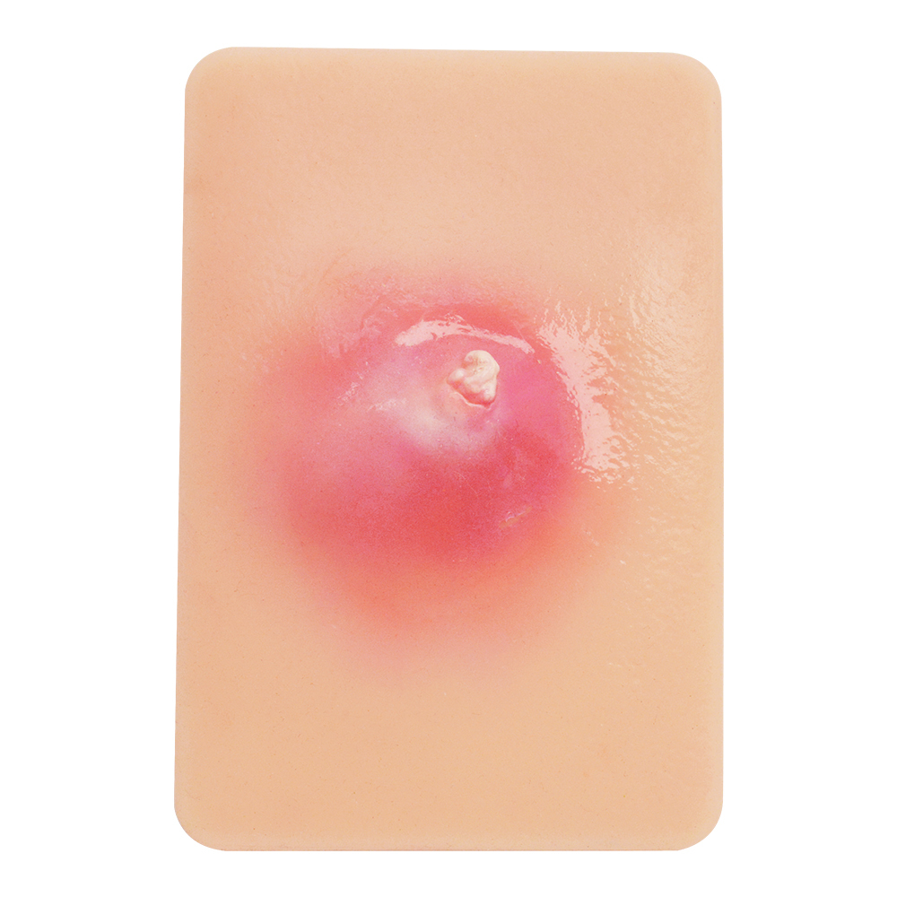Bacterial Infection Display Cards(4 Types)