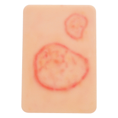 Fungal Infection Display Cards(2 Types)