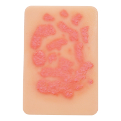Fungal Infection Display Cards(2 Types)