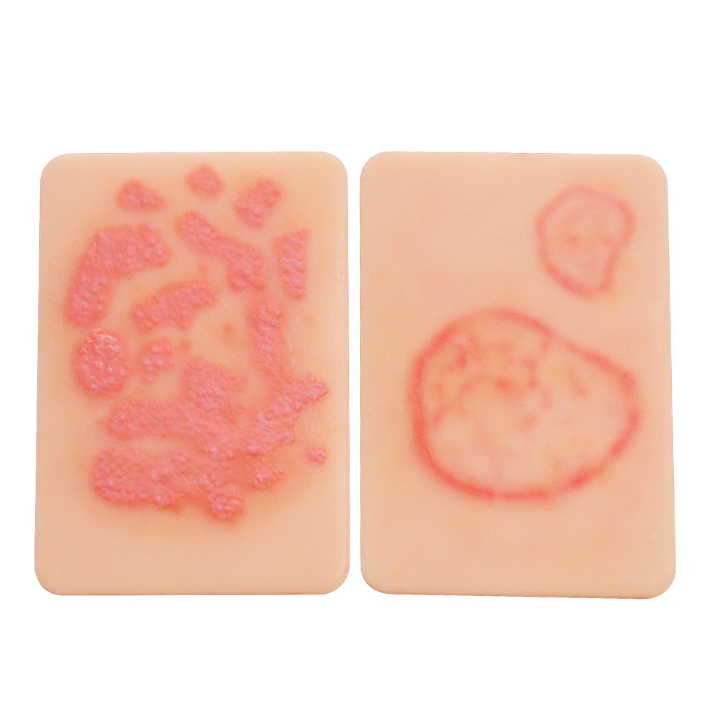 Fungal Infection Display Cards(2 Types)