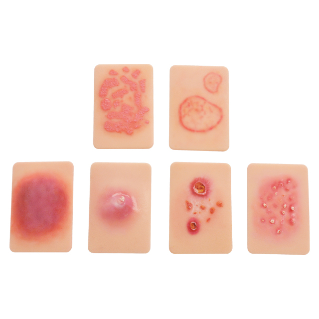Fungal Infection Display Cards(2 Types)