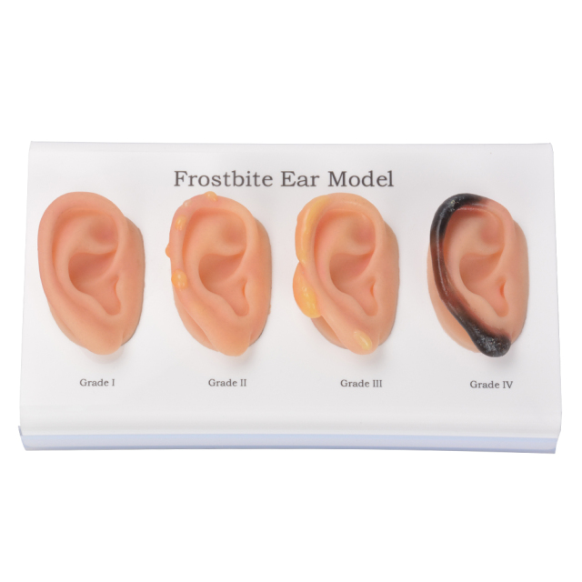 Frostbite Ear Model (Grade1-4)