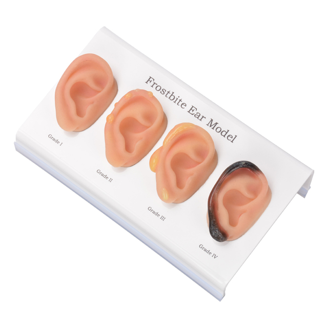 Frostbite Ear Model (Grade1-4)