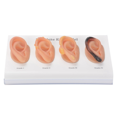 Frostbite Ear Model (Grade1-4)