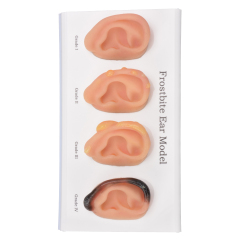 Frostbite Ear Model (Grade1-4)