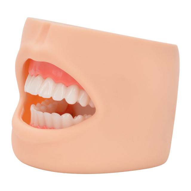 Dental Care Model With Cheek