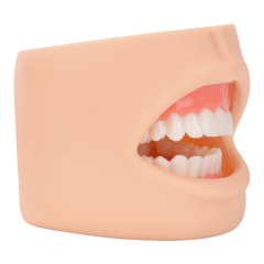 Dental Care Model With Cheek