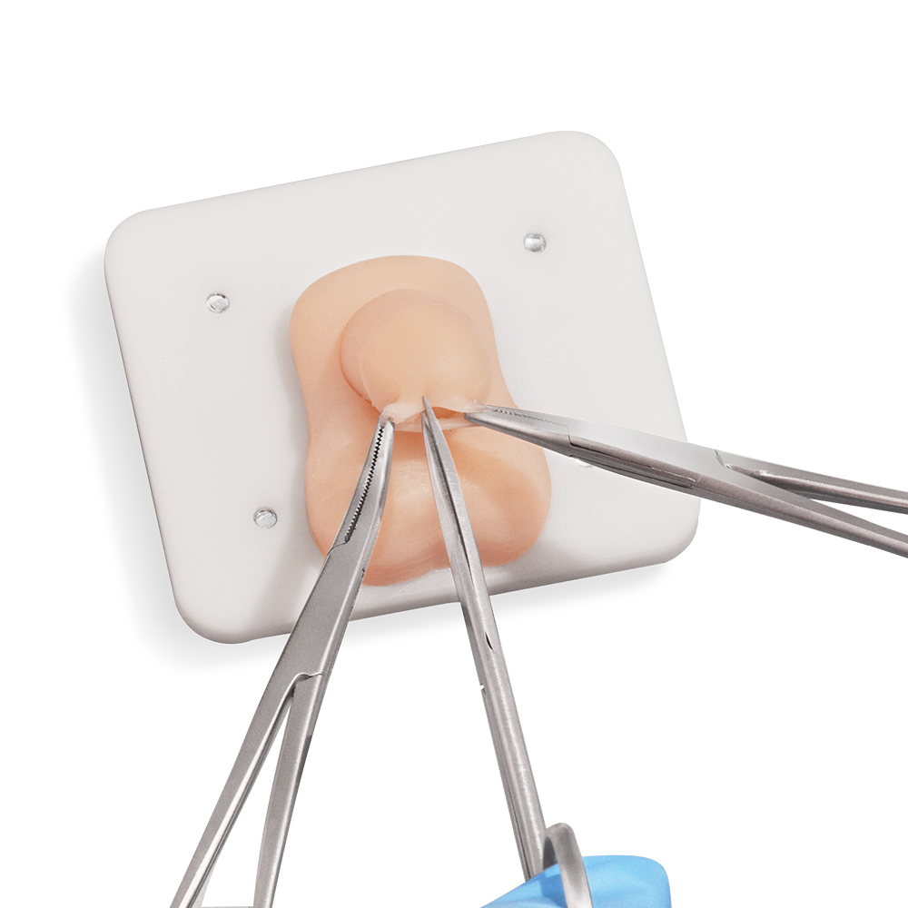Infant Circumcision Training Model with Replaceable Foreskin