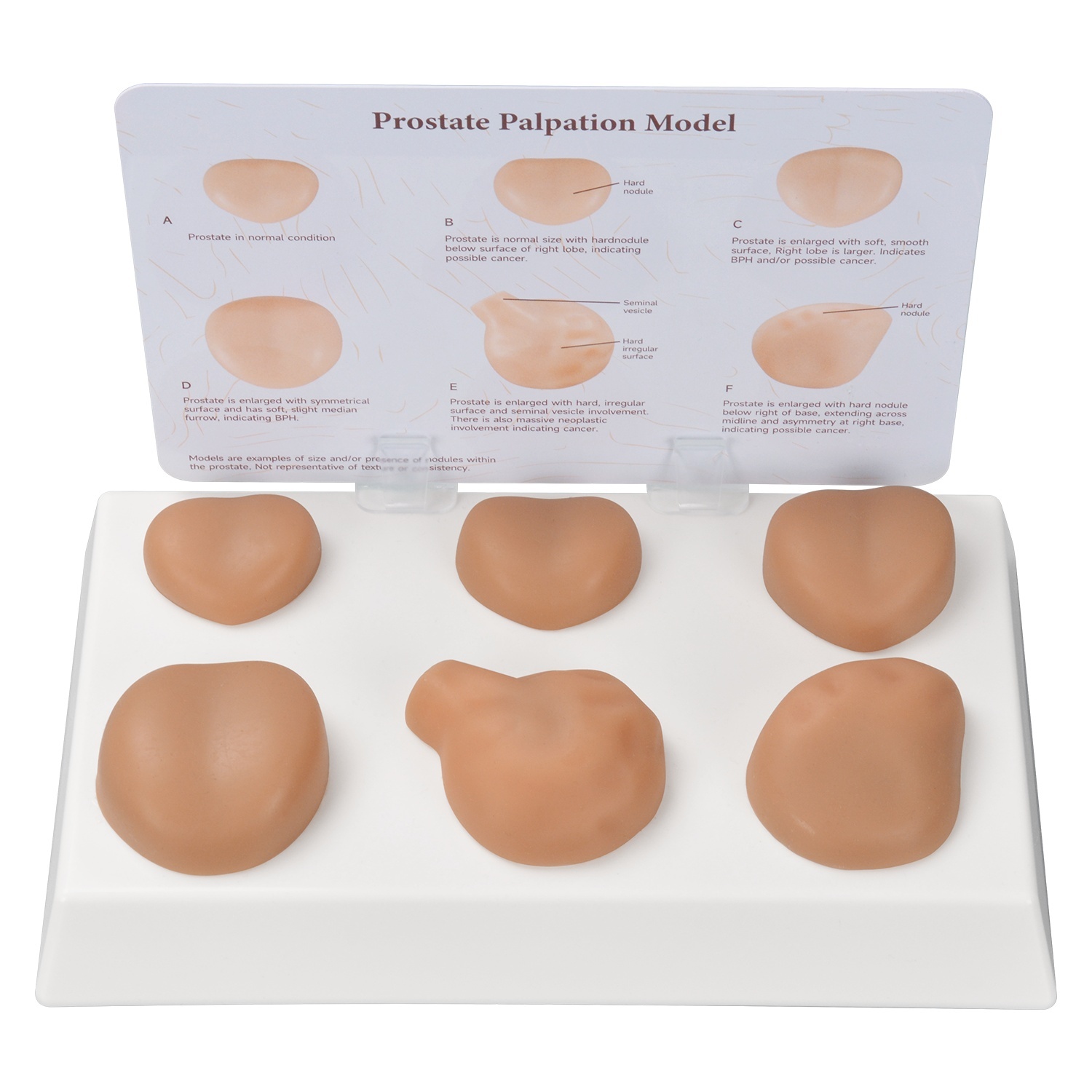 Prostate Palpation Education Model