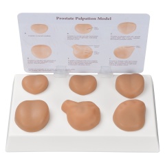 Prostate Palpation Education Model
