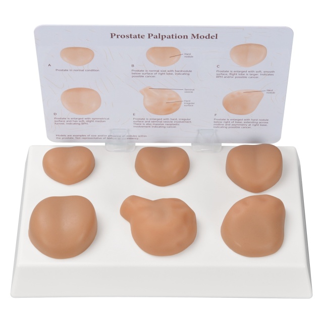 Prostate Palpation Education Model