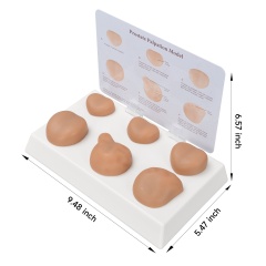 Prostate Palpation Education Model