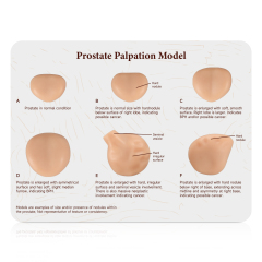 Prostate Palpation Education Model