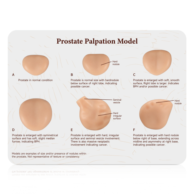 Prostate Palpation Education Model