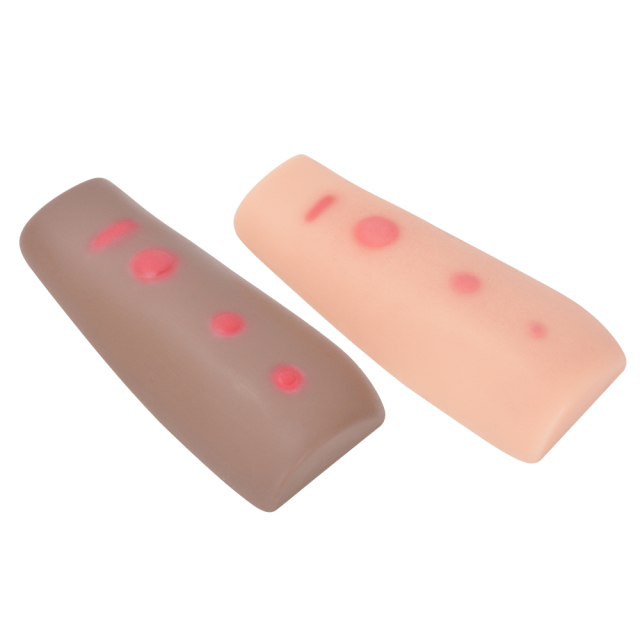 Palpable TB Testing Arm Set