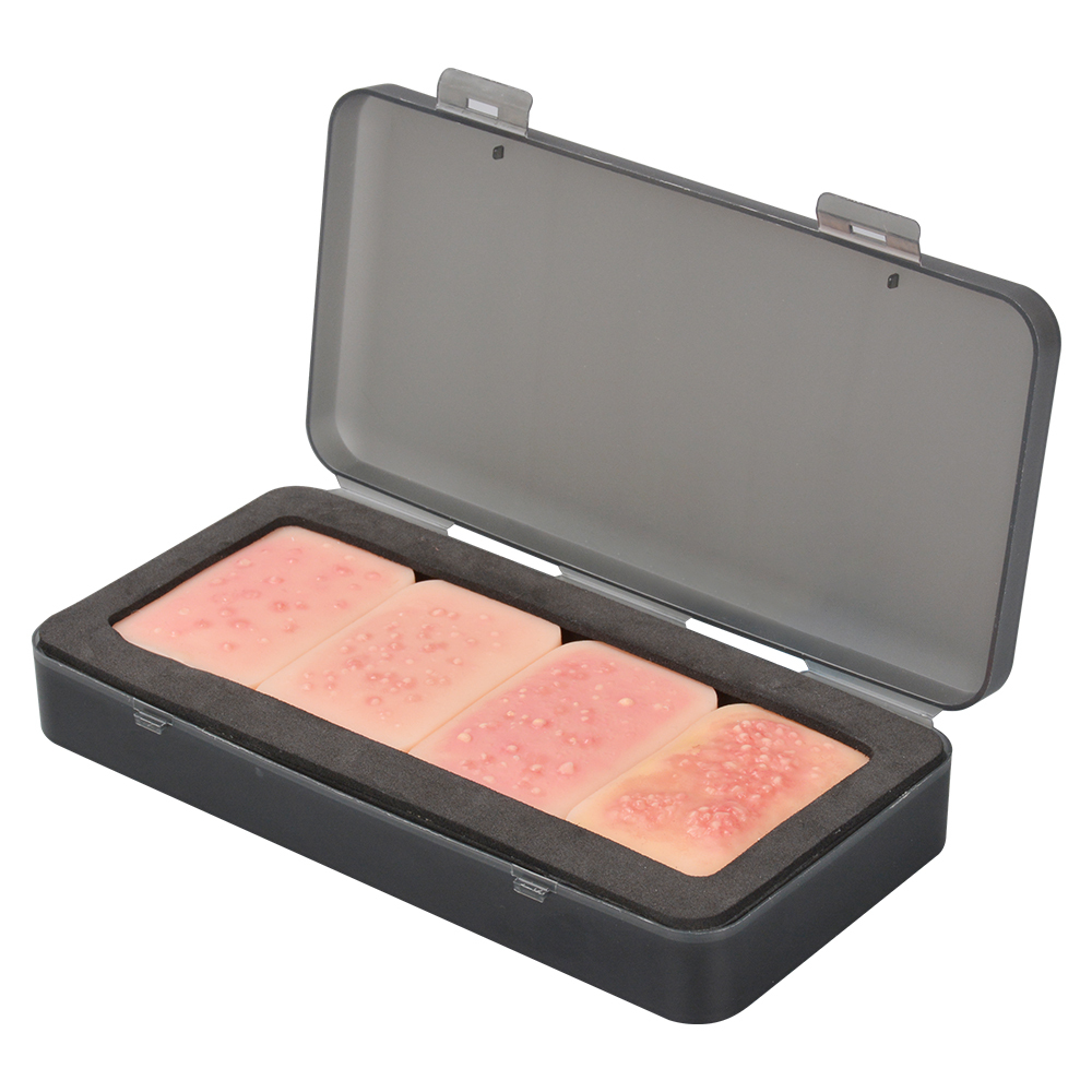 4-Stage Silicone Facial Acne Display Model