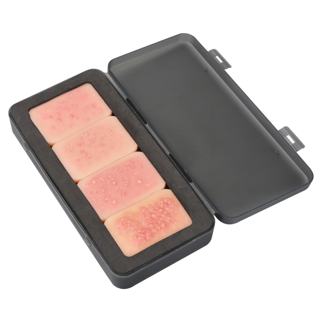 4-Stage Silicone Facial Acne Display Model