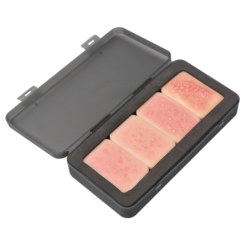 4-Stage Silicone Facial Acne Display Model