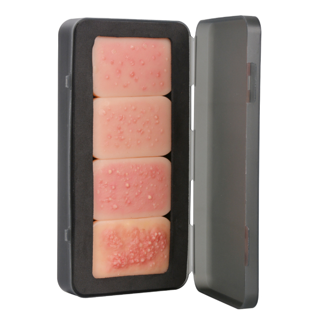 4-Stage Silicone Facial Acne Display Model