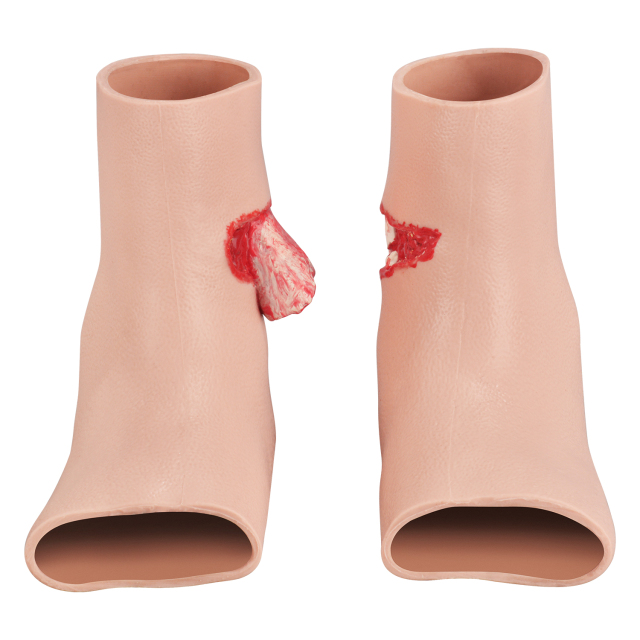 Foot Trauma Simulation Wound Model