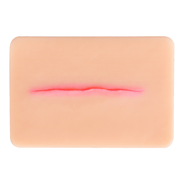 Atrophic Scar Simulation Model