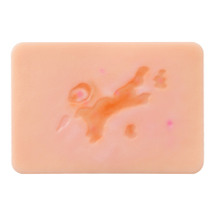 Atrophic Scar Simulation Model