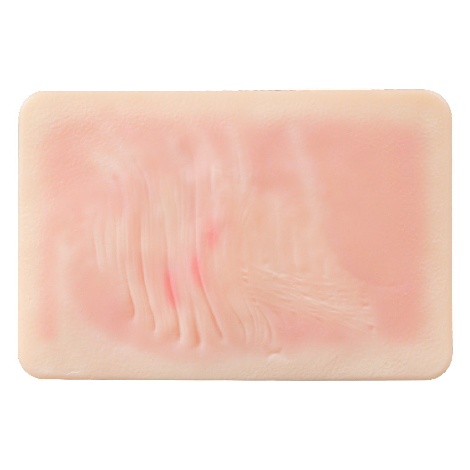 Atrophic Scar Simulation Model