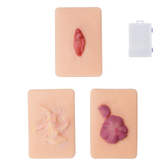 Scar Hyperplasia Wound Simulation Model