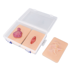 Scar Hyperplasia Wound Simulation Model