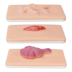 Scar Hyperplasia Wound Simulation Model