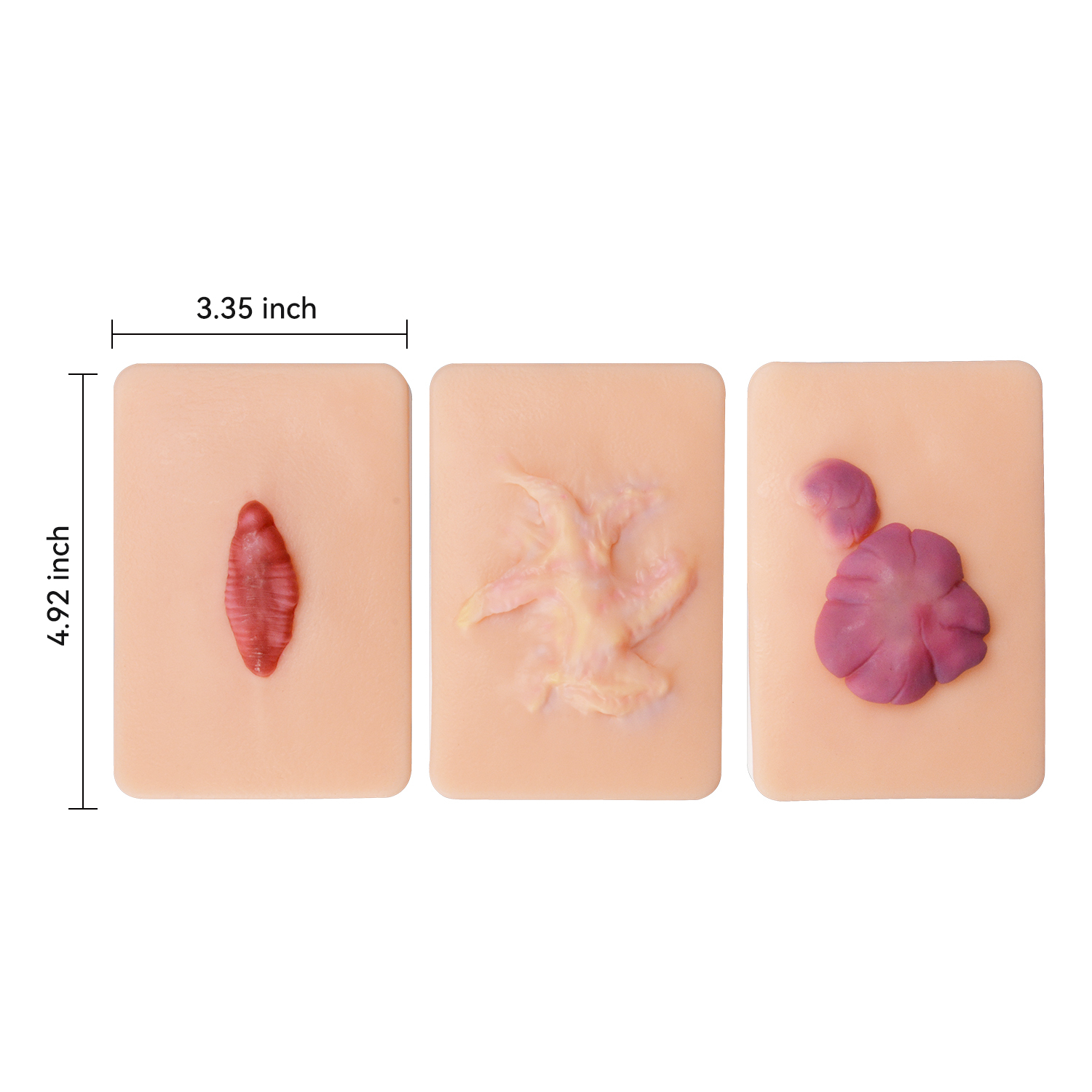 Scar Hyperplasia Wound Simulation Model