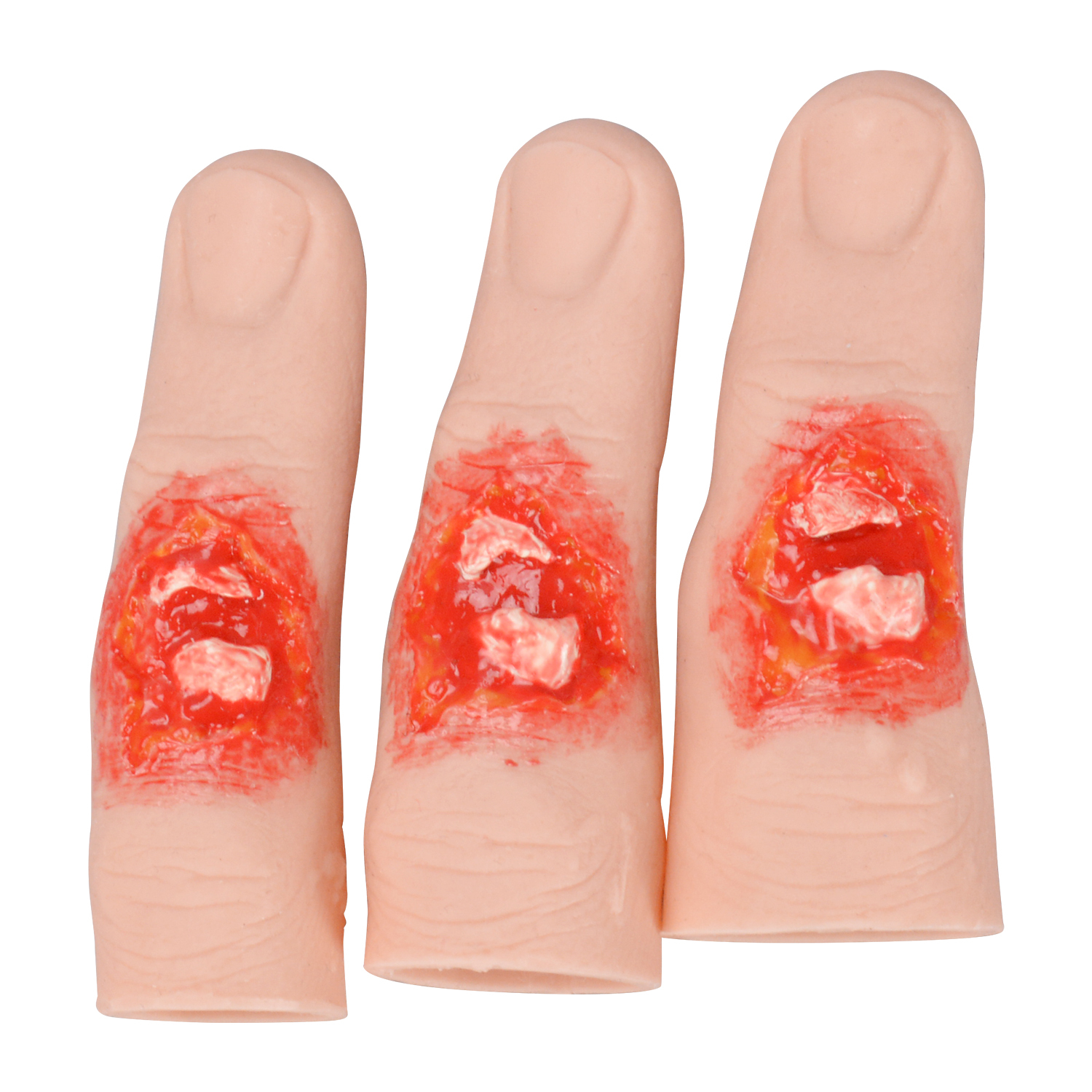Wearable Finger Fracture Wound Trainer