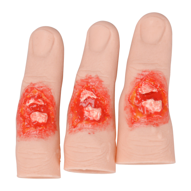Wearable Finger Fracture Wound Trainer