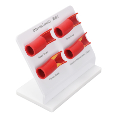Atherosclerosis Anatomical Model
