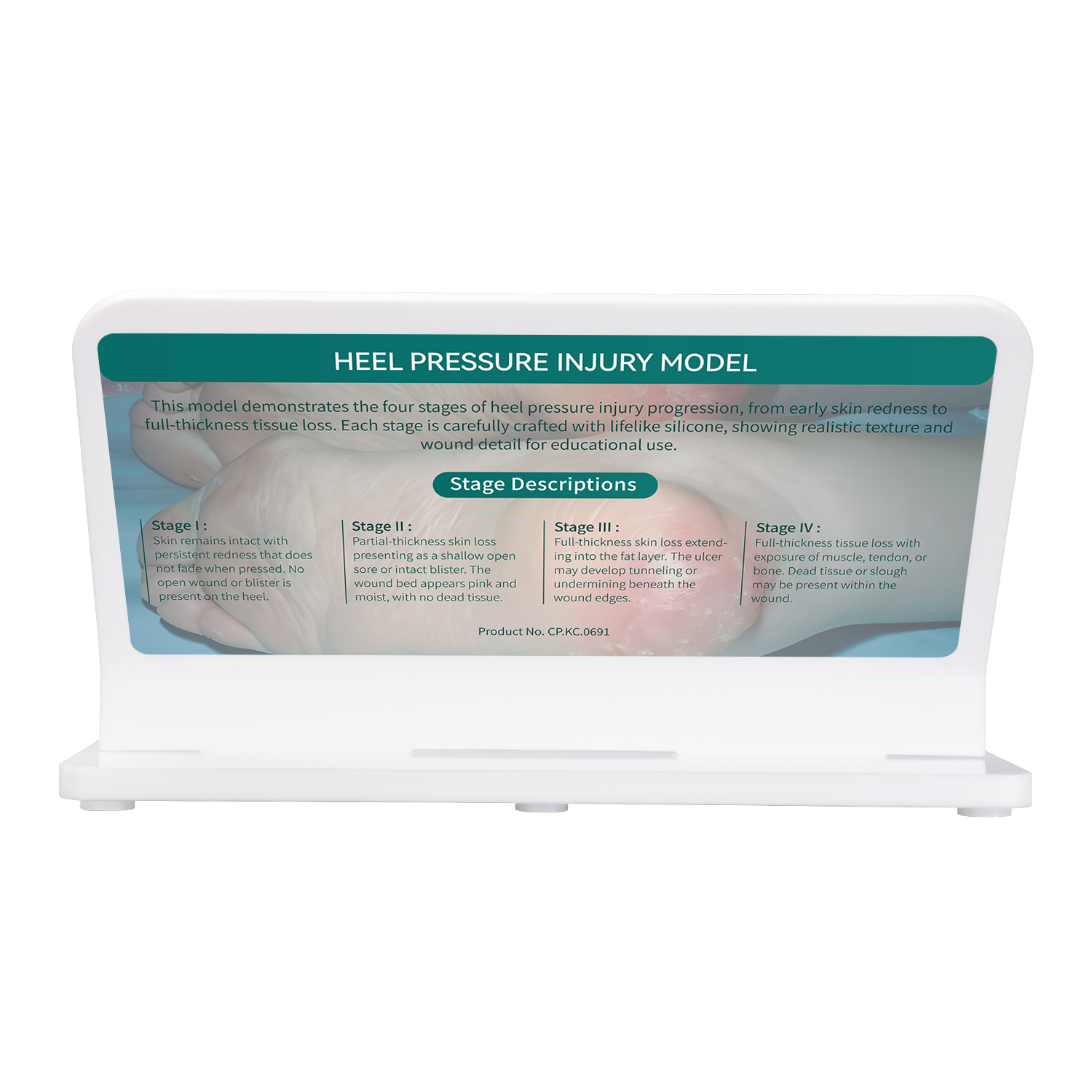 Heel Pressure Injury Stages Display Model