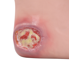 Wearable Heel Pressure Ulcer Foot Sleeve