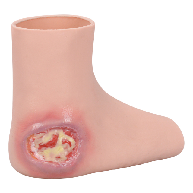 Wearable Heel Pressure Ulcer Foot Sleeve