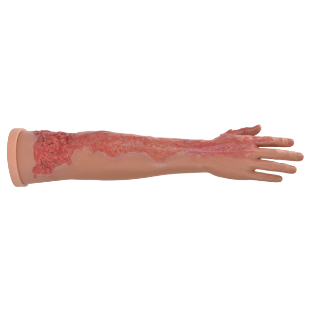 Full Arm Burn Wound Simulation Model