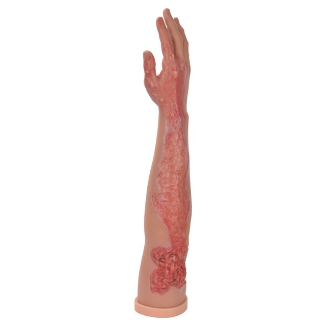 Full Arm Burn Wound Simulation Model