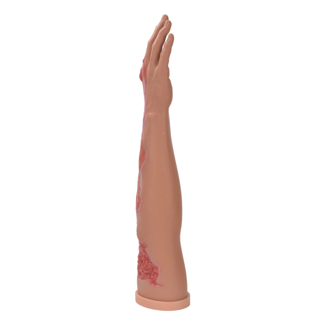 Full Arm Burn Wound Simulation Model