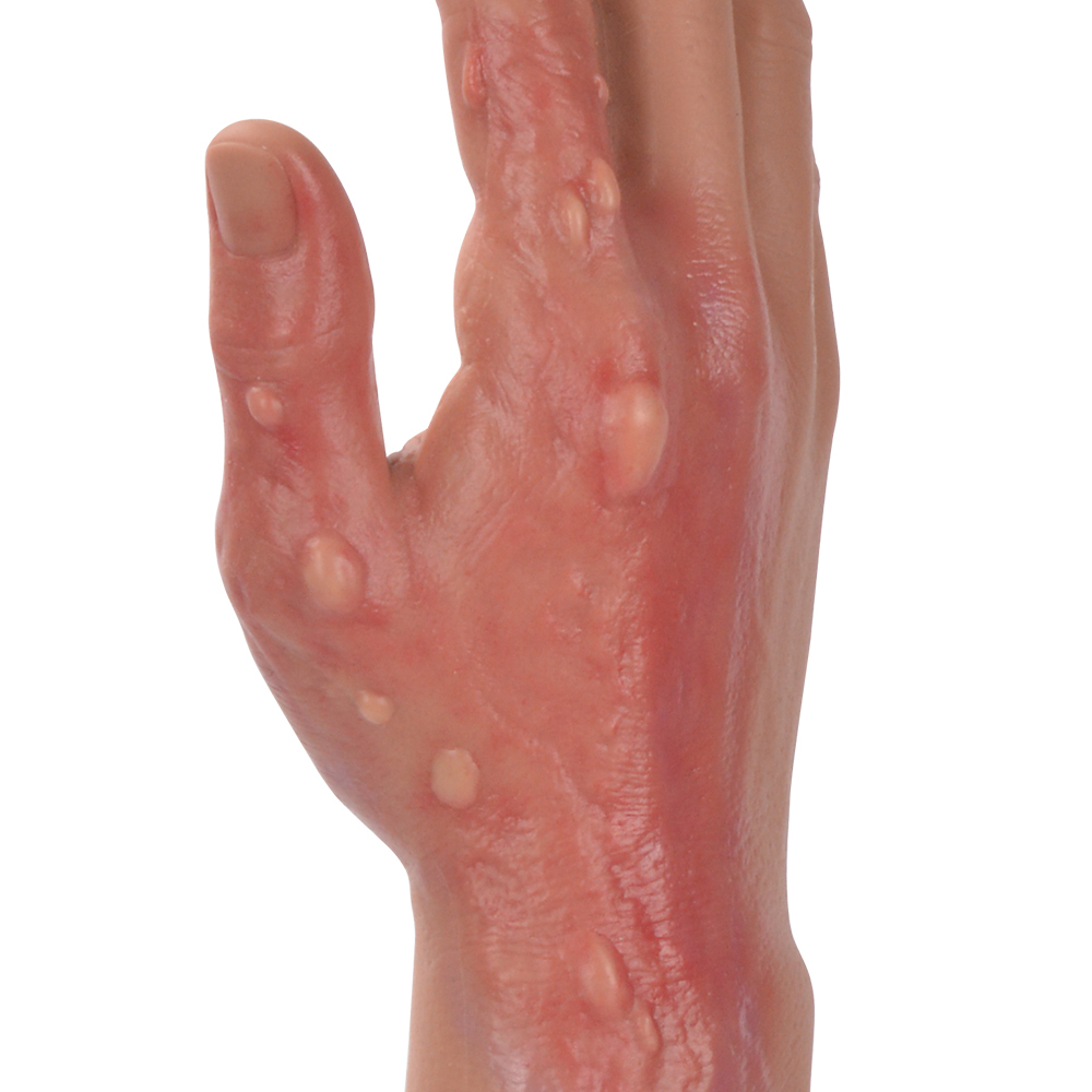 Full Arm Burn Wound Simulation Model