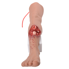 Lower Leg Fracture Full Leg Training Model