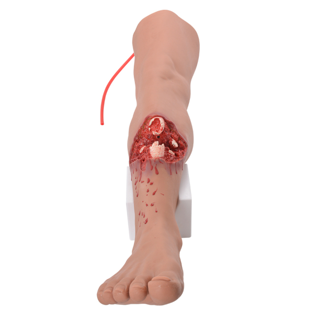 Lower Leg Fracture Full Leg Training Model