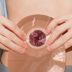 Sticky Unhealthy Stoma Simulation Models for Ostomy Care Training