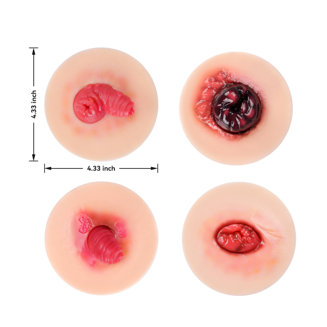 Sticky Unhealthy Stoma Simulation Models for Ostomy Care Training