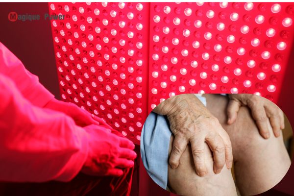 Red Light Therapy for Lymphedema