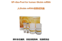 Human Globin mRNA Removal Kit