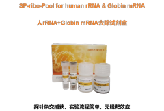 人rRNA+Globin mRNA去除试剂盒